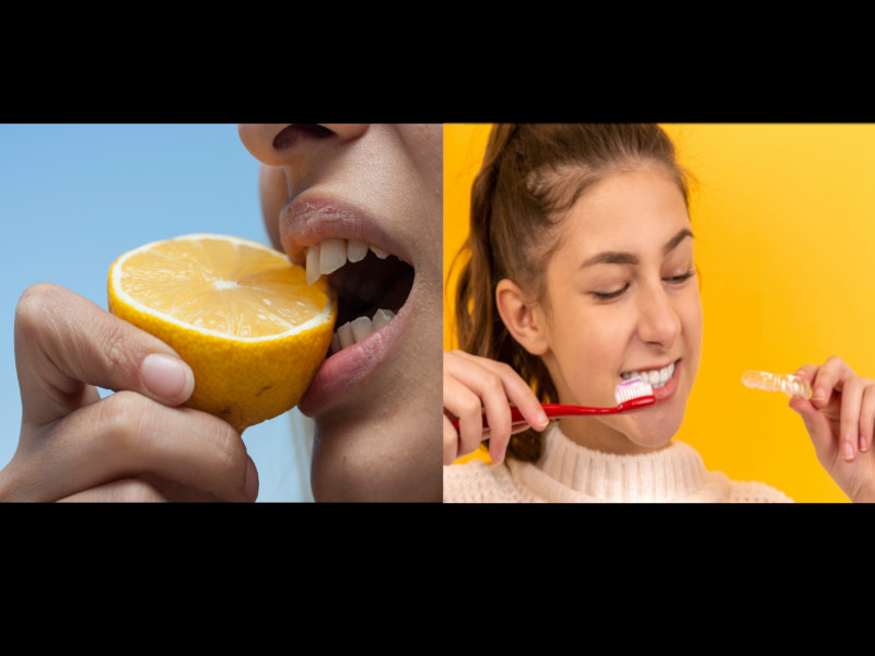 Denti Sani e Igiene Orale: Carie e Prevenzione